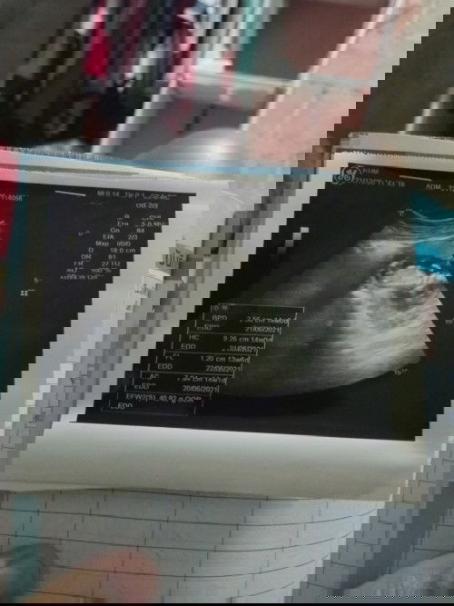 กำลังตั้งครรภ์ท้อง2คะ