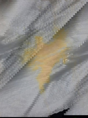 เต้าอักเสบ/ฝี ไหมคะ