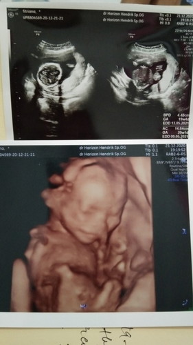 it's a girlπππ€π€