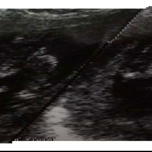 Berawal dari dua garis merah, perjuangan “kita” dimulai #ibujuara Part 2