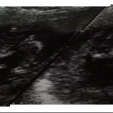 Berawal dari dua garis merah, perjuangan “kita” dimulai #ibujuara Part 2