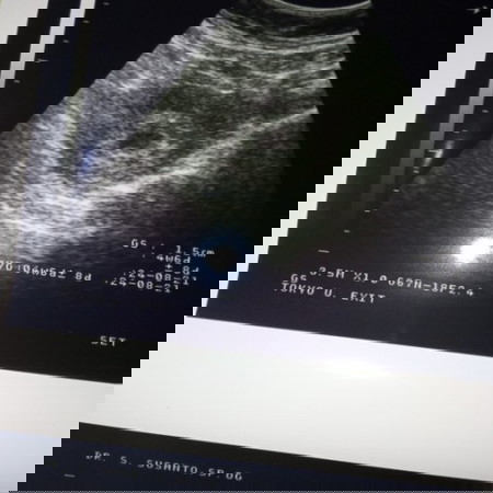 Assalamualaikum, bagi pengalaman nya dong bun,, wajar gak sih kalo perkiraan bidan sama dokter beda.