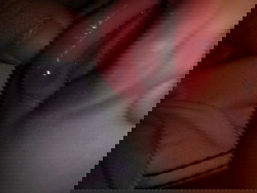 Sugat sa labi ni baby