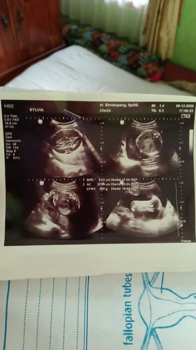 Bun, mau tny dong kok hamil 7bln perut masih keliatan kecil, awal bln usg berat janin 866gr , sesuai