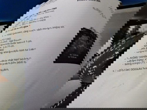 Ai xem giúp em với các mom ơi