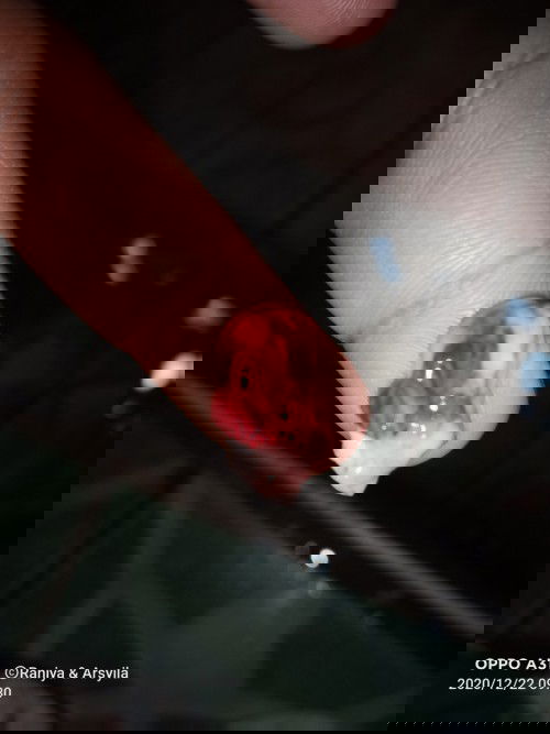 Keluar seperti ini pas pipis