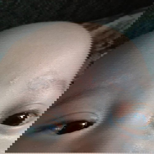 ini kulit agak kering kenapa ya?