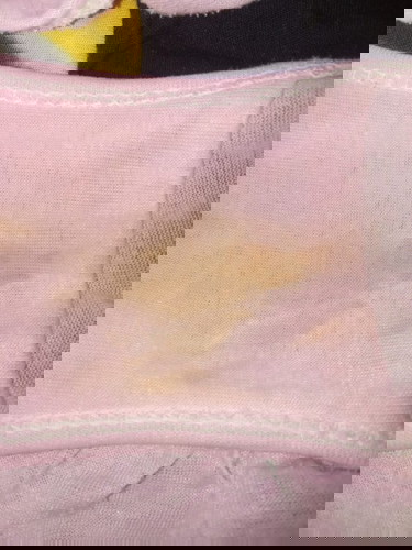 Ka sya mau nanya sy sdh trlat haid 17 hari, dn siang tdi sy kluar ky gtu apa itu implatasi /bkn