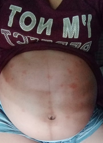 Sino kagaya ko meron nito😥