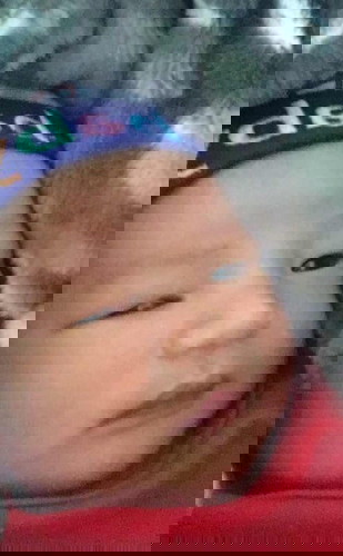 ลูกตาซ้ายไม่ขยับ