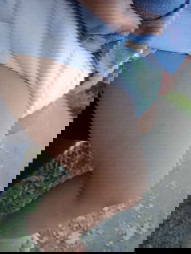 Rashes po ba ito? Pahelp naman po