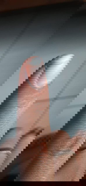 Keputihan berwarna putih