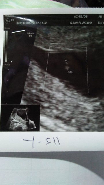 Sebaiknya gimana ya...