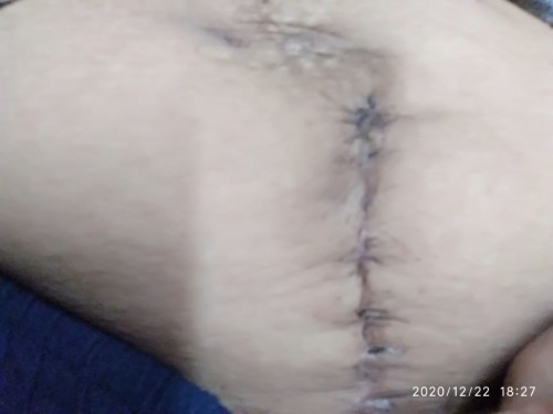 kenapa ya cesar aku jelek banget