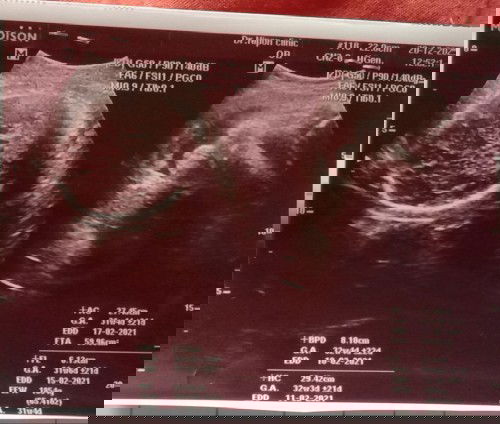 อยากทราบเพศลูกคร้า