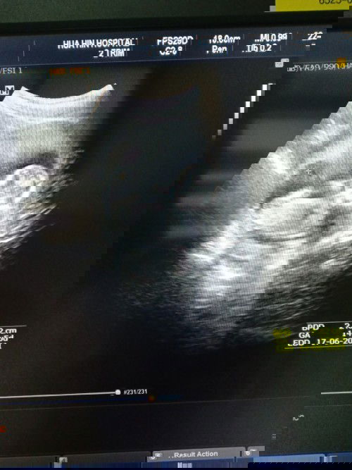 ช่วยทายเพศน้อง