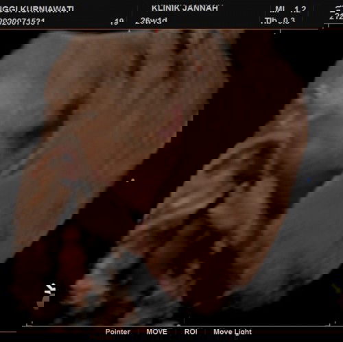 Pregnant 26 week 1 day