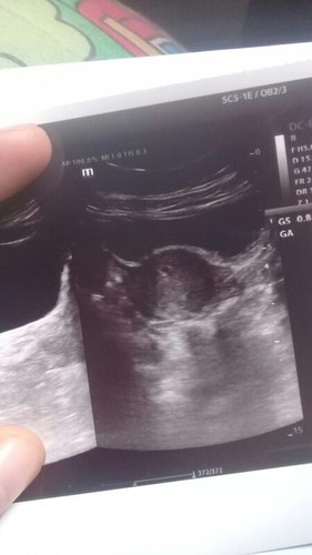 Scan Tapi...