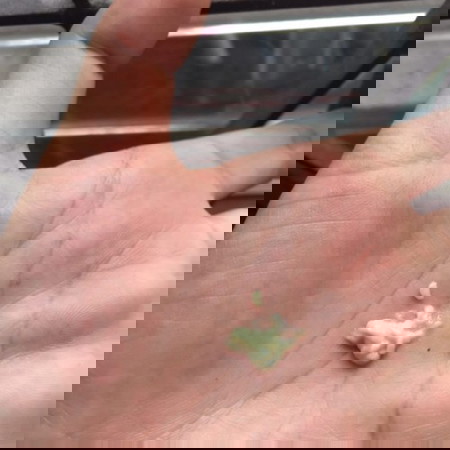 ใครมีตกขาวสีเหลืองอ่อนๆไม่คันแบบนี้บ้างคะปกติของคนท้องใช่มั้ย !!?