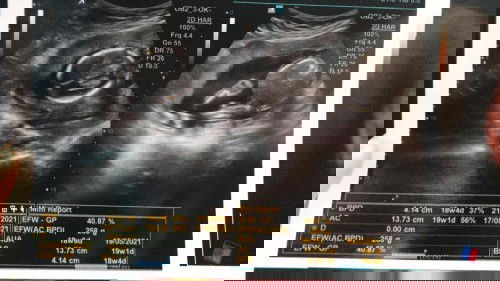 USG 19w Yang Membahagiakan