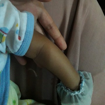 Bingung puting bayi sulit gemuk