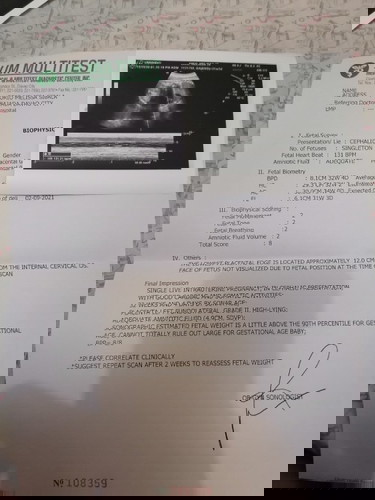 My Ultrasound result