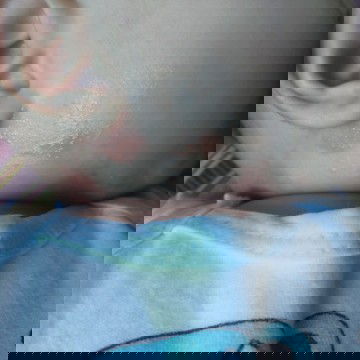 hi mga mommy ano po pwede ipahid or gamot po sa leeg ni baby nag rarashes po Kasi ? thank you