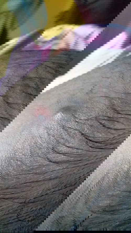 Benjolan kecil di kepala bayi