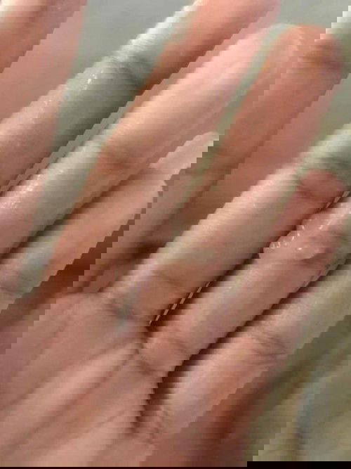 แม่ๆค่ะ แบบนี้ใช่มูกใสไหมค่ะ