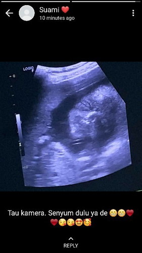 Kontraksi USIA 26 week