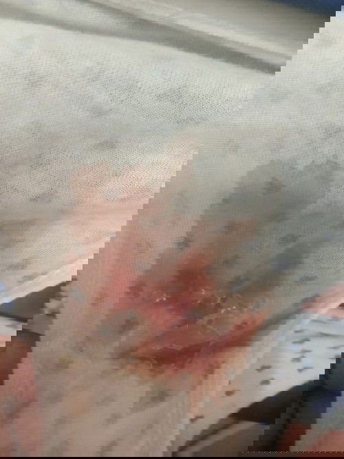 หลังจากโดนตรวจปากมดลูกเปิด2เซ็น 38+1w#กำหนดคลอด5มกราคม