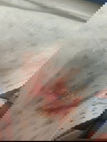 หลังจากโดนตรวจปากมดลูกเปิด2เซ็น 38+1w#กำหนดคลอด5มกราคม