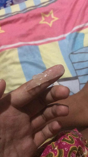 ใช้มูกไสไหมค่ะ