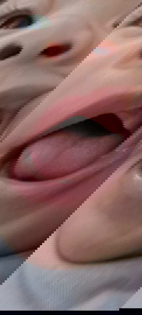 Canine ang first teeth