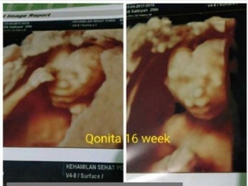 #IbuJuara anak pertama setelah mengalami 3 kali gagal hamil selama 10 tahun pernikahan