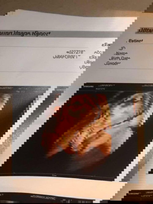 น้องมีสิทธิ์ดั้งโด่งไหมคะแม่ๆ