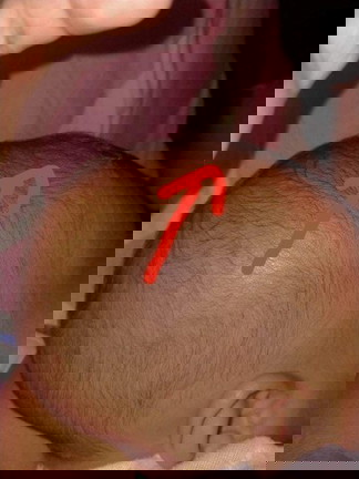 Hello mga kapwa ko mga mommies, worry lang ako kasi yung bunbunan ng baby ko ang taas, any answer po