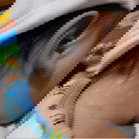 Ano po kaya pwede kung treament sa skin ni baby