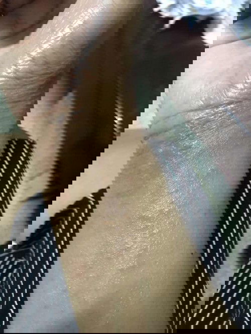 บันทึกการเปลี่ยนแปลงหลังคลอด