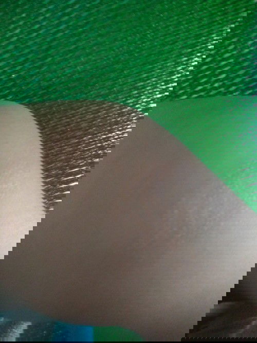 bé nha e dc 5thang ma bị như z
bôi j het may mom