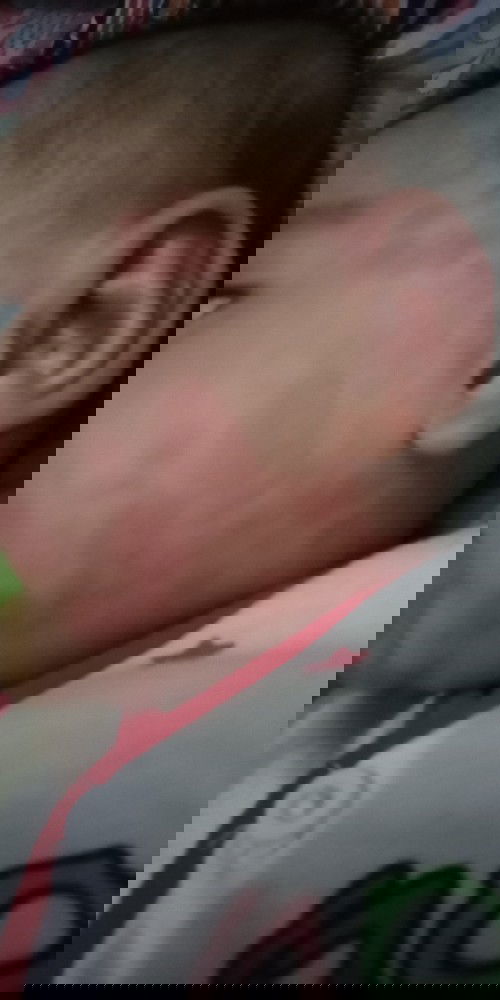 Merah merah di kulit bayi