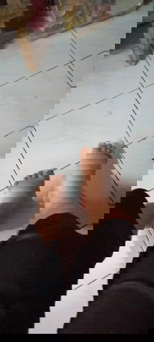 Mengatasi kaki bengkak