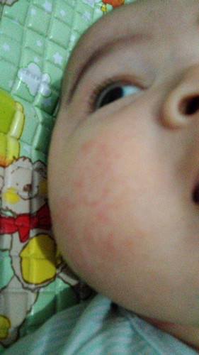 Ruam pipi bayi 3bln