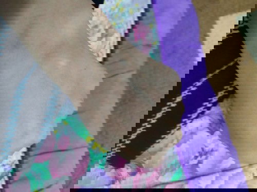 benjolan di tangan ...tiba² je adan. korang tahu tak kenapa??