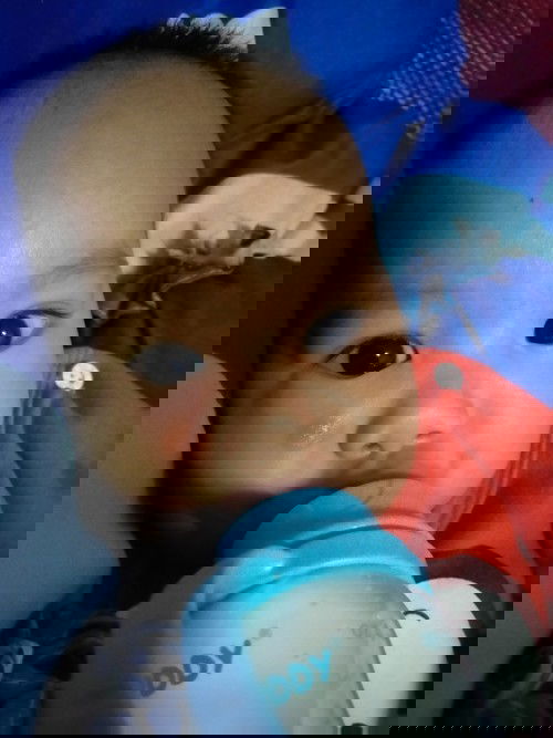 น้องบ้านไหนเคยเป็นบ้างค่ะ