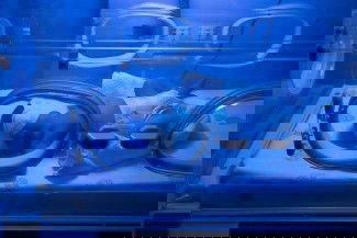 Bunda, Bayi Kuning Normal kok 😊
Deteksi kuning sedini mungkin berdasarkan Literatur IDAI dan AAP