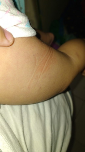 Imunisasi pentabio1 +polio2