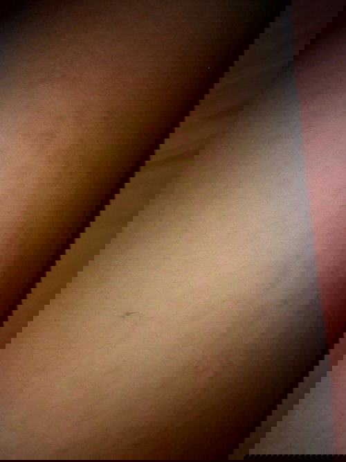 Gatal pasca melahirkan apakah normal??