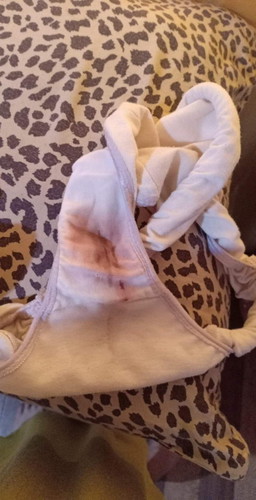 Bleeding in 31 weeks 😢