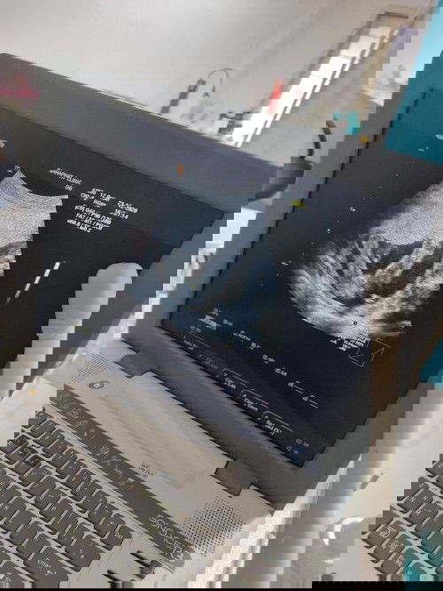 แบบนี้ได้ลูกสาวใช่ไหมค่ะแม่ๆ